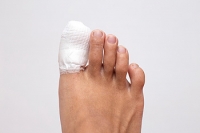 The Differences Between a Sprained Toe and a Broken Toe