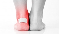 What Is a Blister and Why Do They Develop?